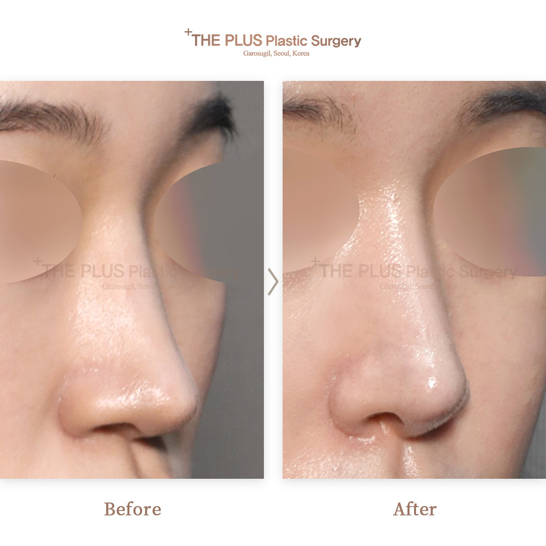 THE PLUS CLINIC KOREA -