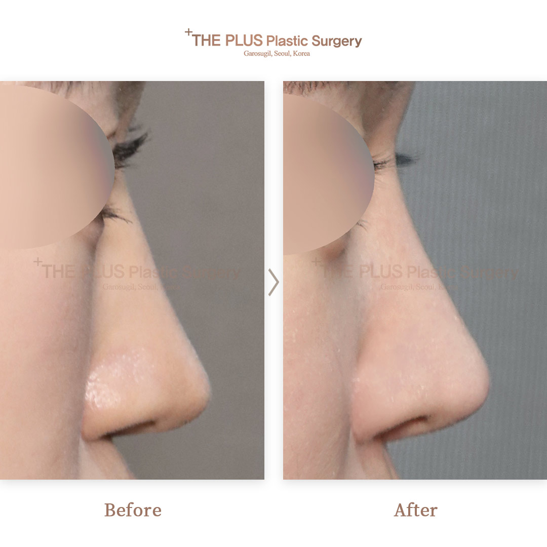 THE PLUS CLINIC KOREA -