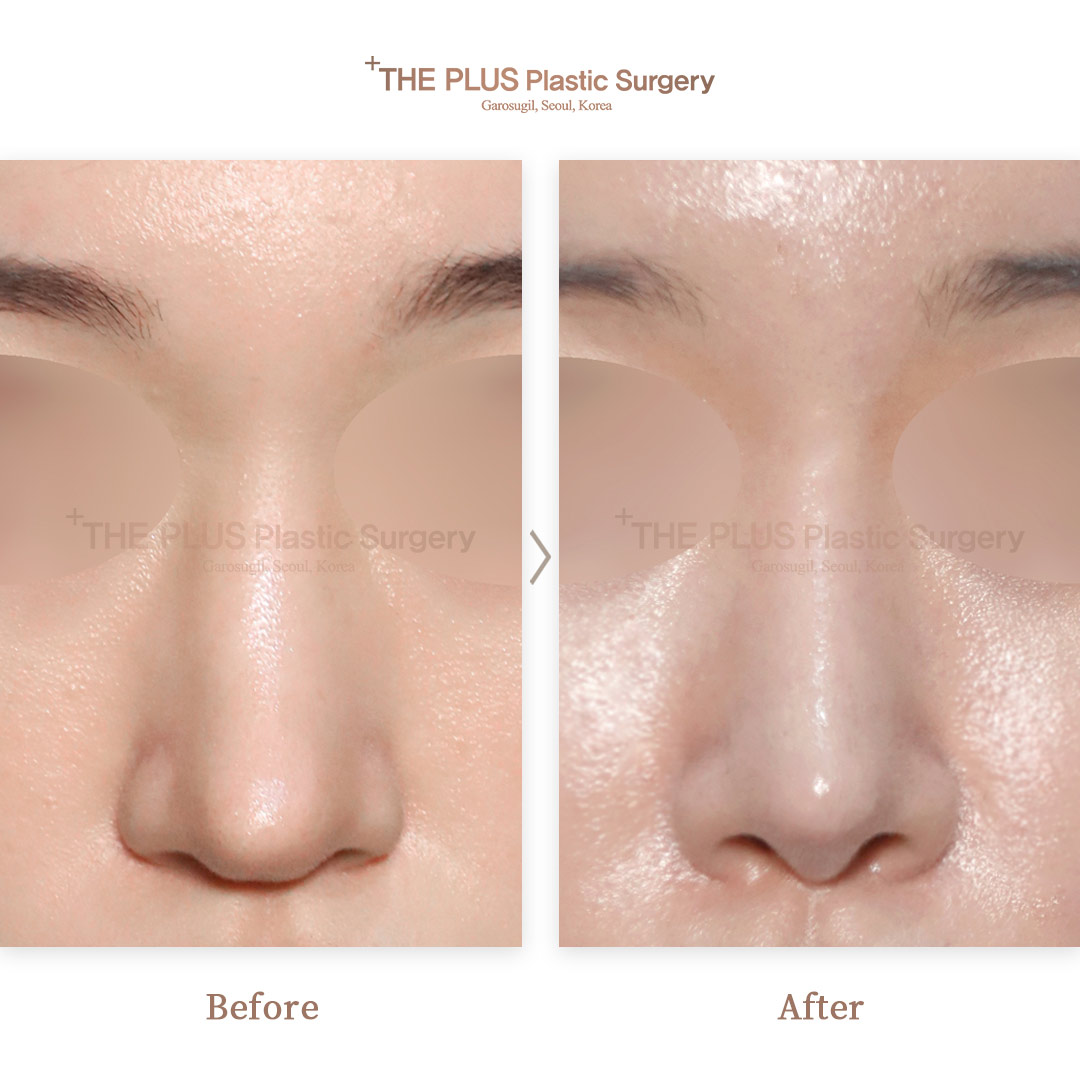 THE PLUS CLINIC KOREA -