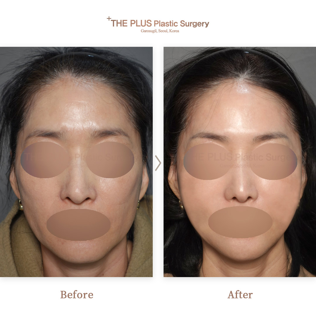 THE PLUS CLINIC KOREA -