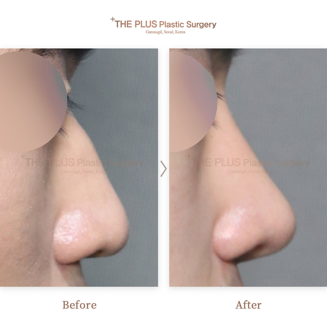 THE PLUS CLINIC KOREA -