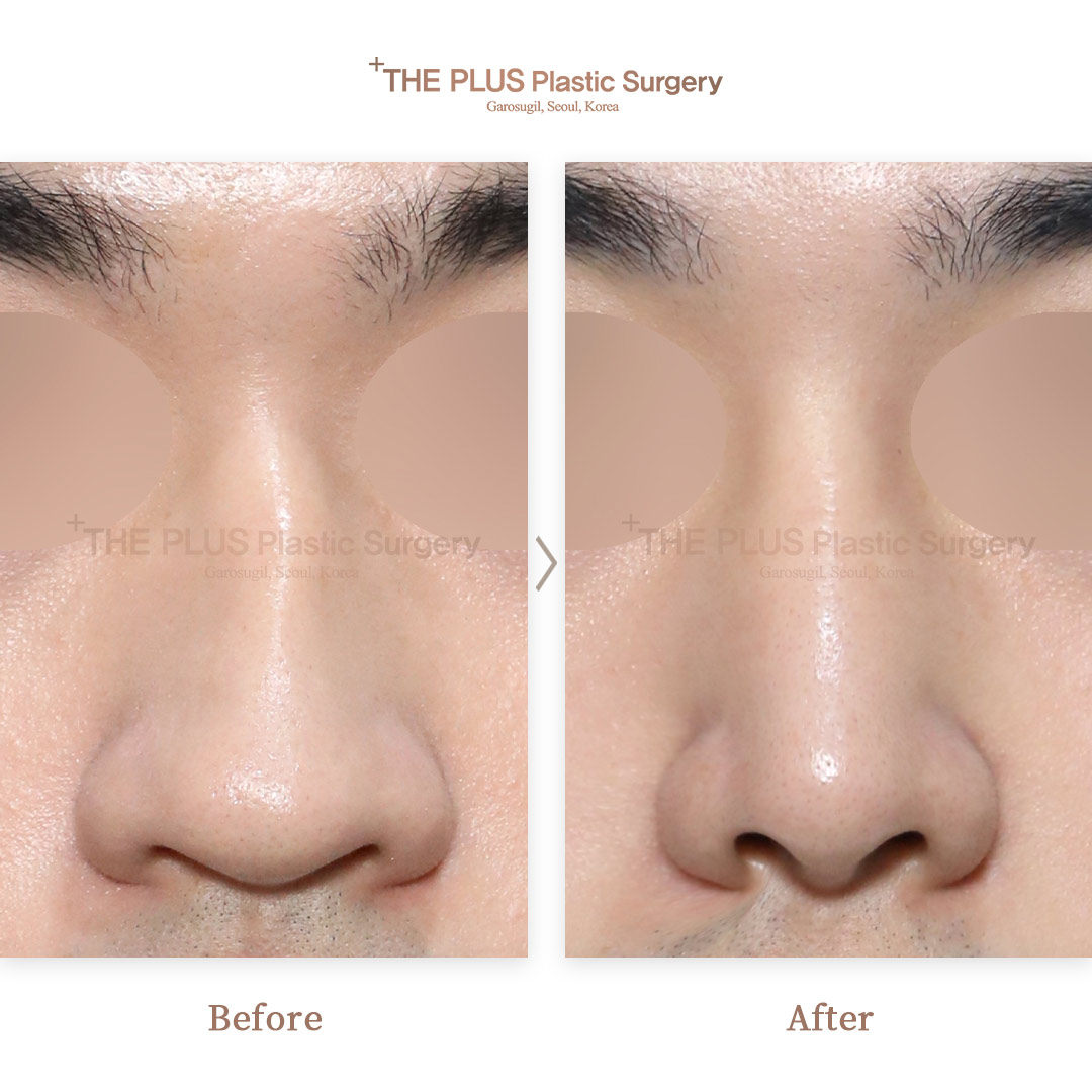 THE PLUS CLINIC KOREA -