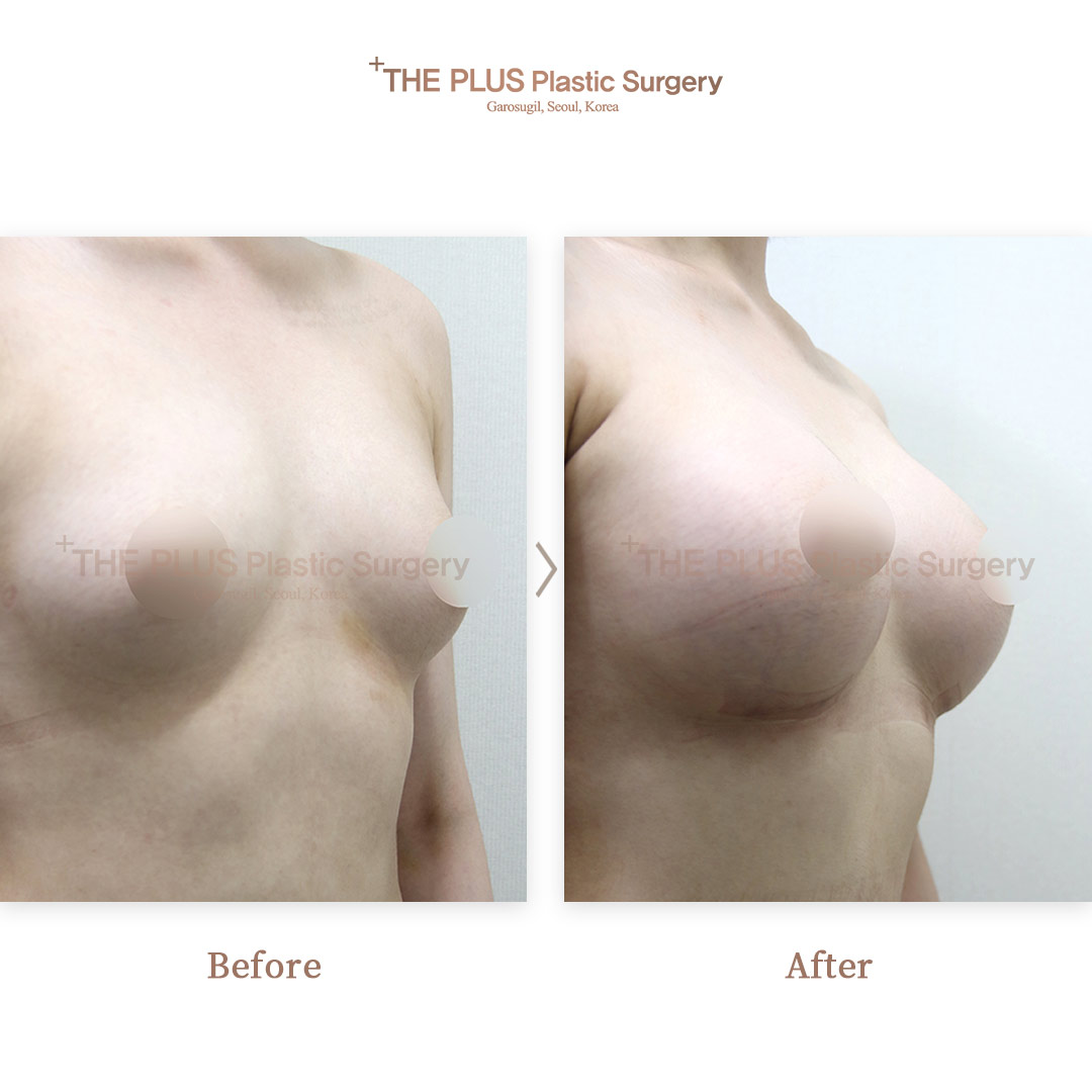 THE PLUS CLINIC KOREA -