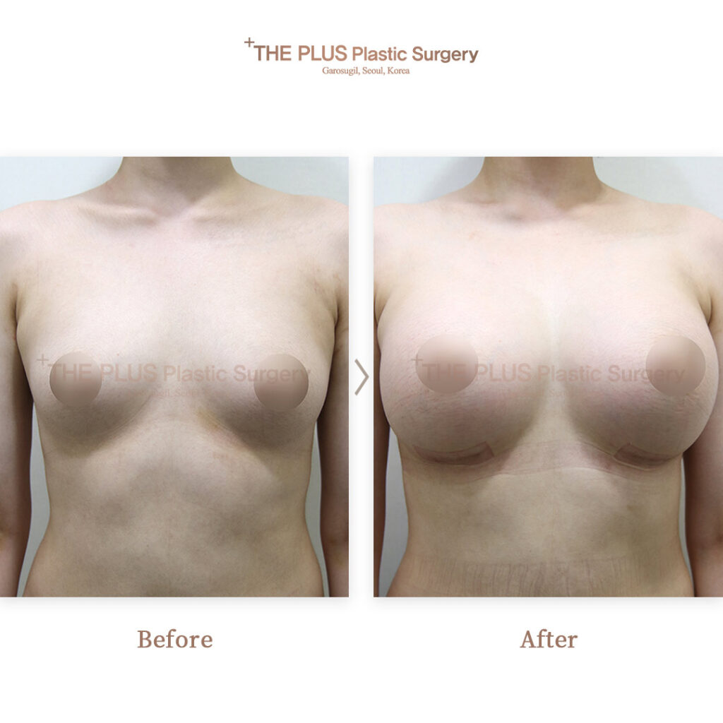 THE PLUS CLINIC KOREA -