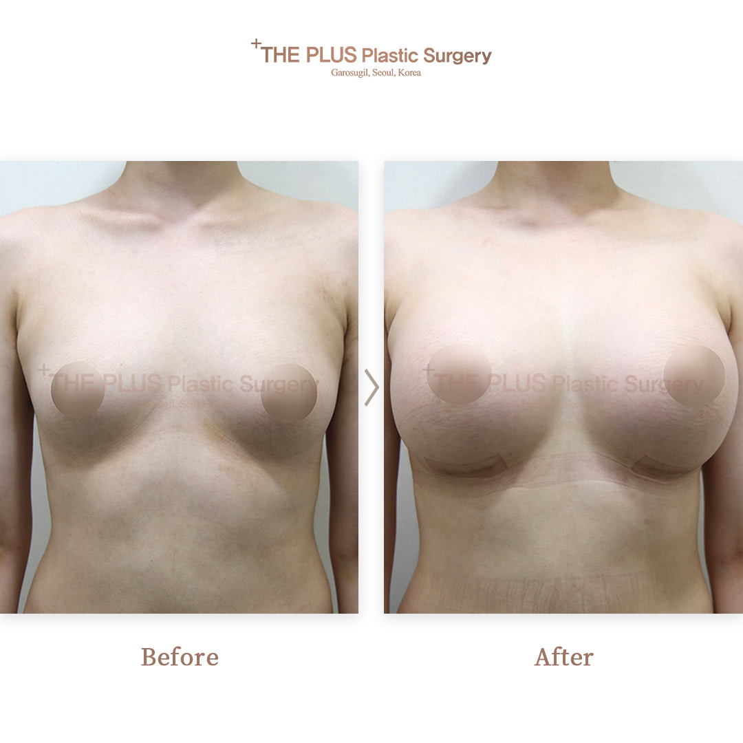 THE PLUS CLINIC KOREA -