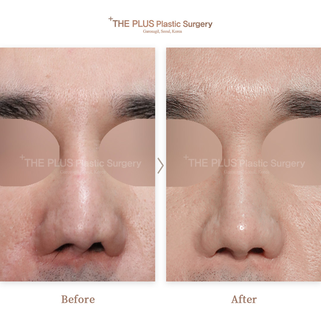 THE PLUS CLINIC KOREA -