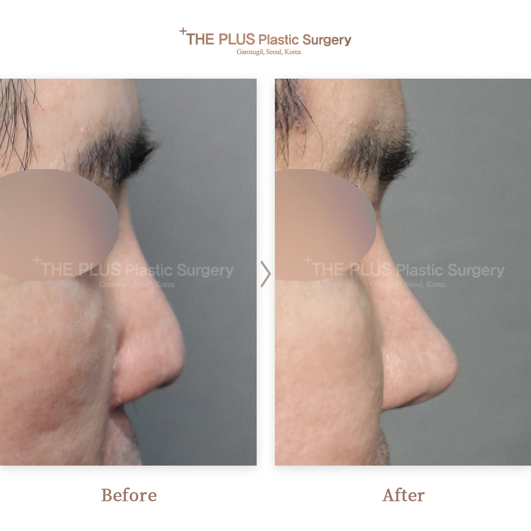 THE PLUS CLINIC KOREA -
