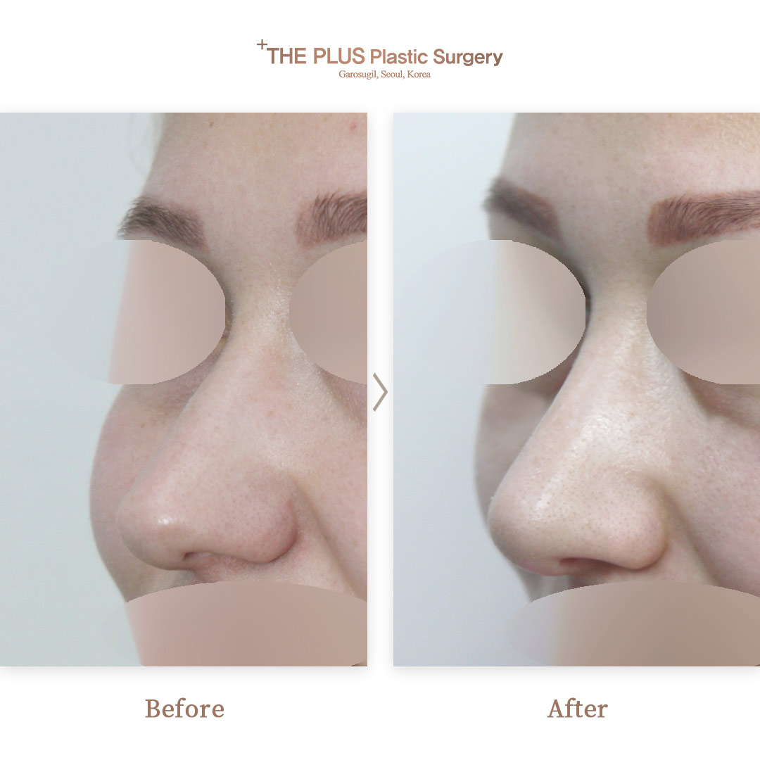 THE PLUS CLINIC KOREA -