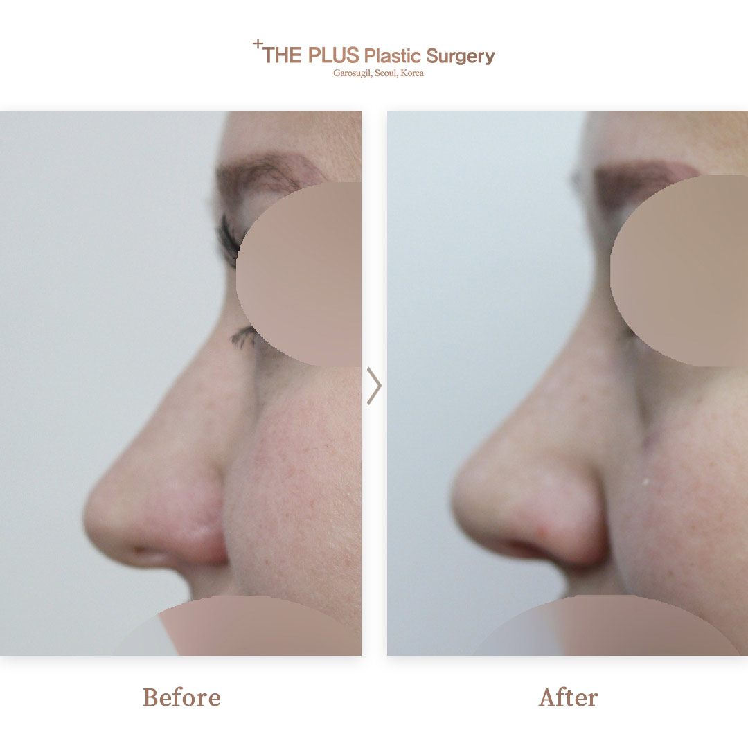 THE PLUS CLINIC KOREA -