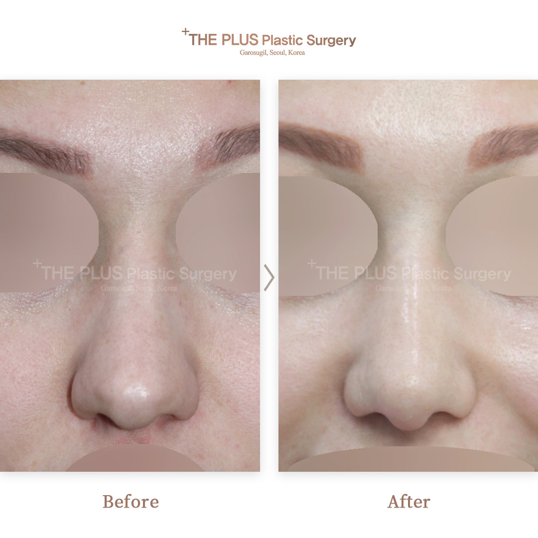 THE PLUS CLINIC KOREA -