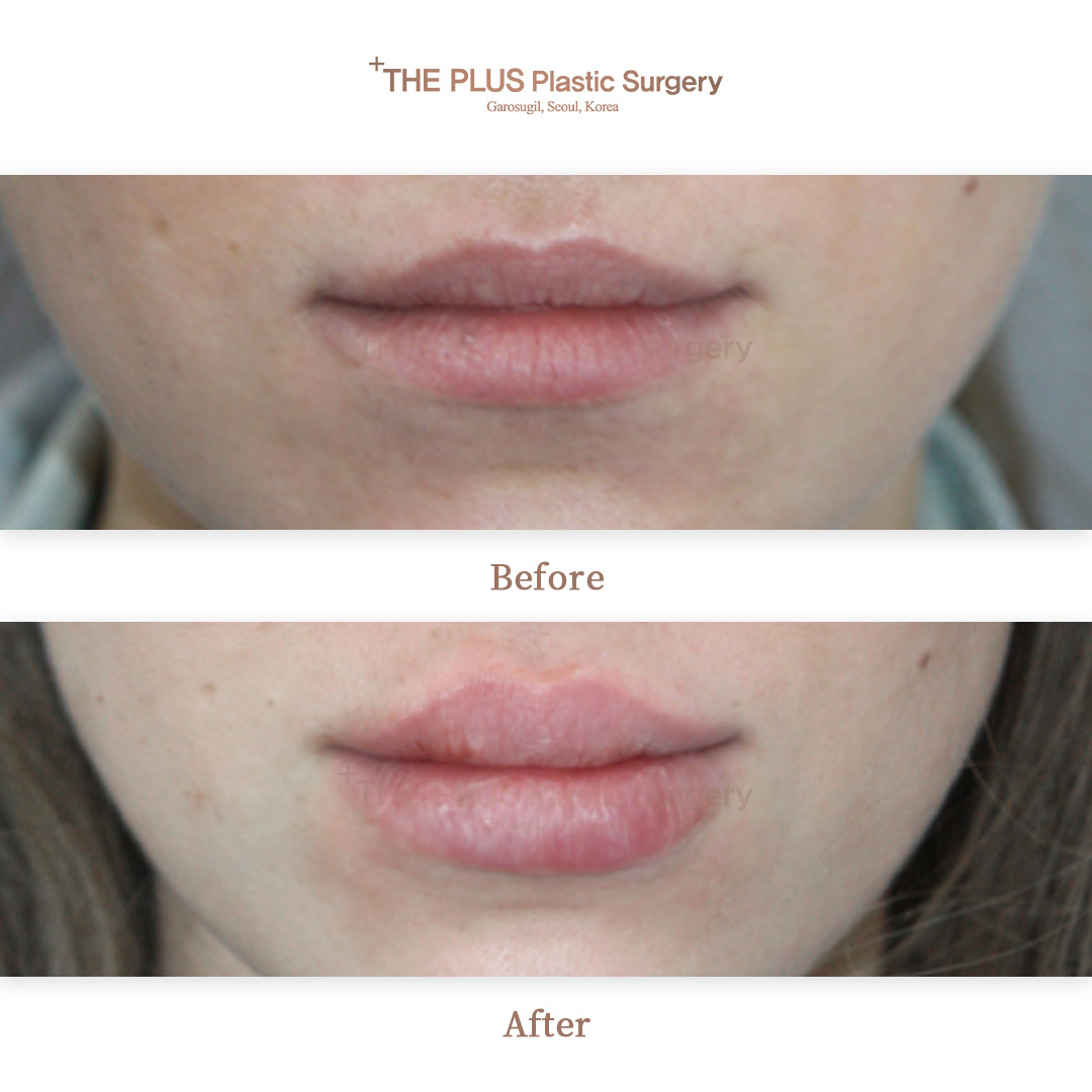 THE PLUS CLINIC KOREA -