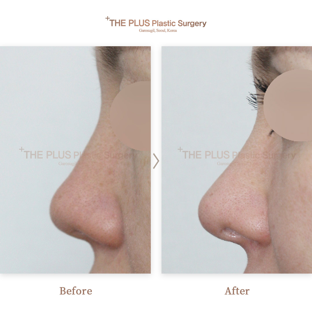 THE PLUS CLINIC KOREA -