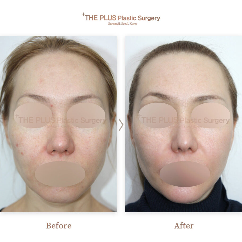 THE PLUS CLINIC KOREA -