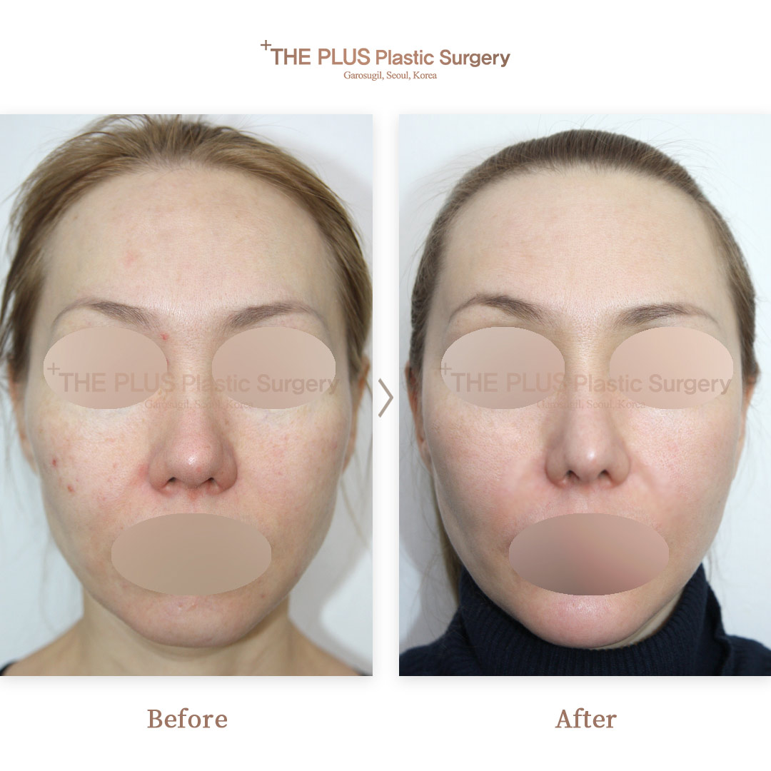 THE PLUS CLINIC KOREA -