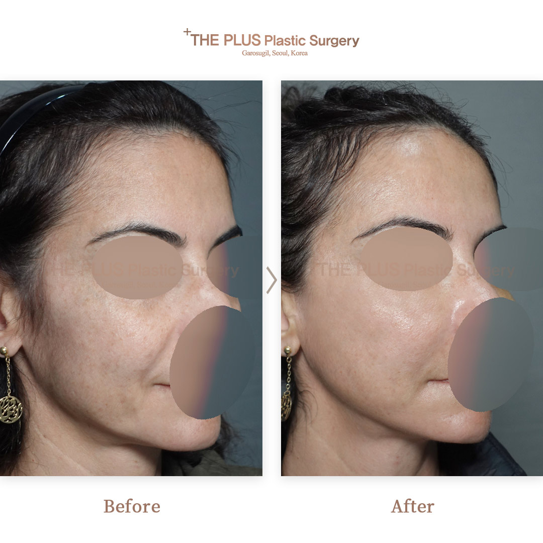 THE PLUS CLINIC KOREA -