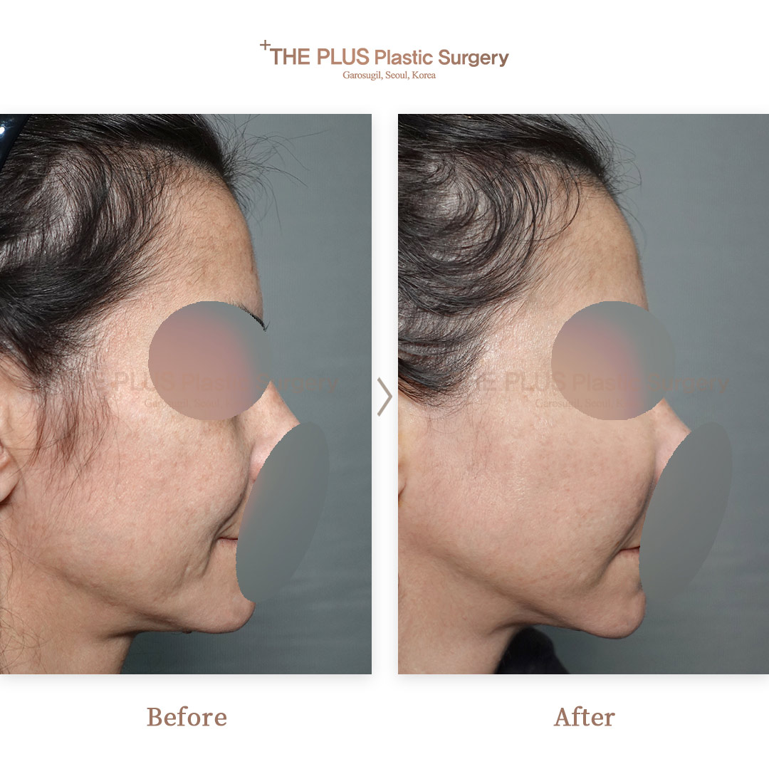 THE PLUS CLINIC KOREA -