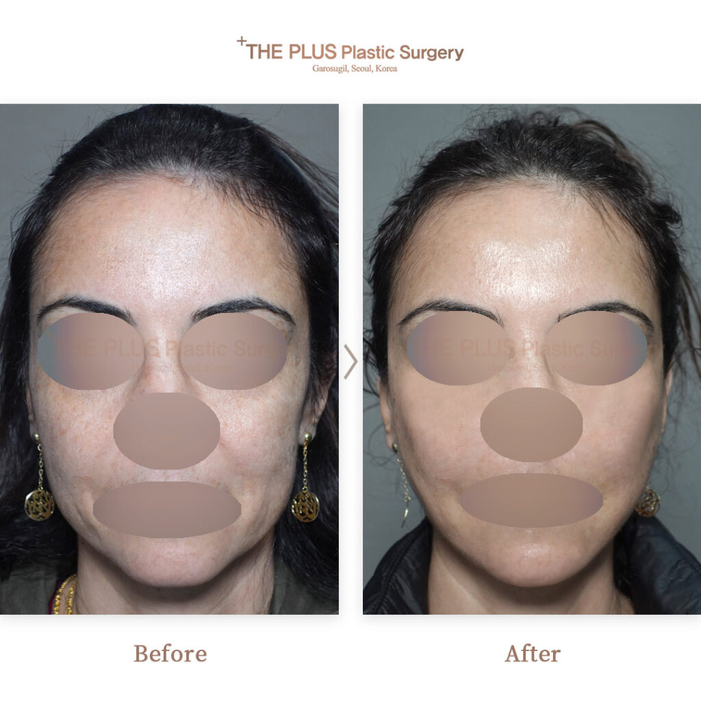 THE PLUS CLINIC KOREA -