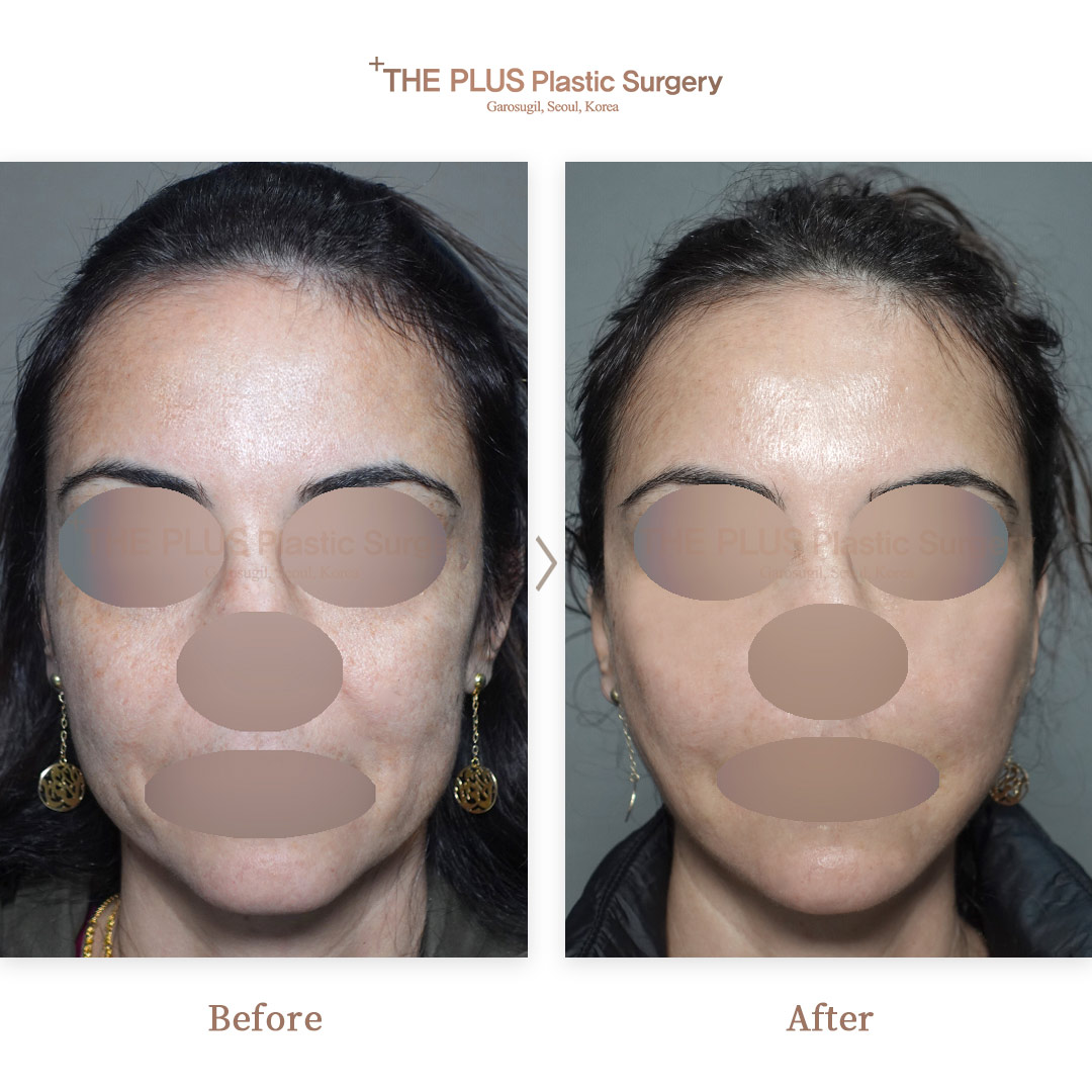 THE PLUS CLINIC KOREA -