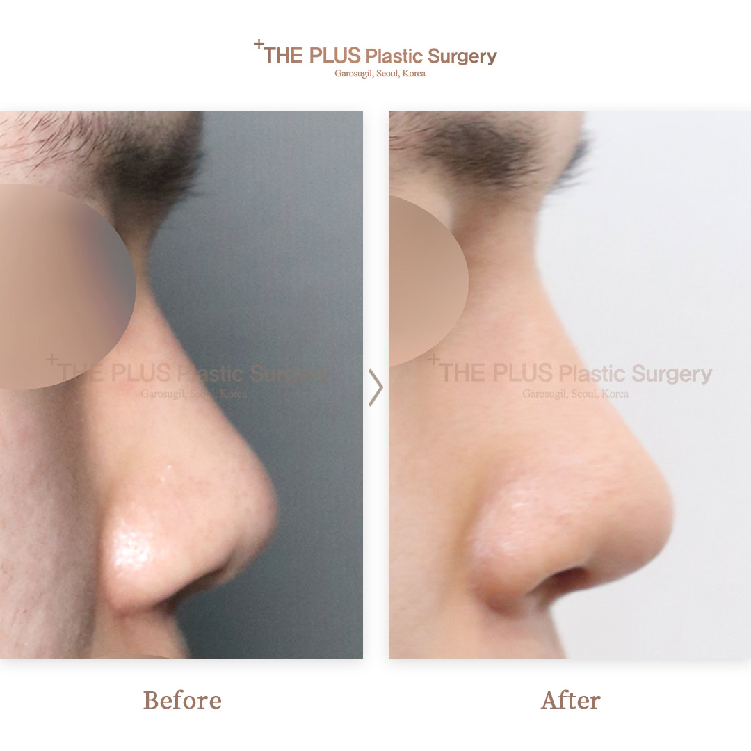 THE PLUS CLINIC KOREA -