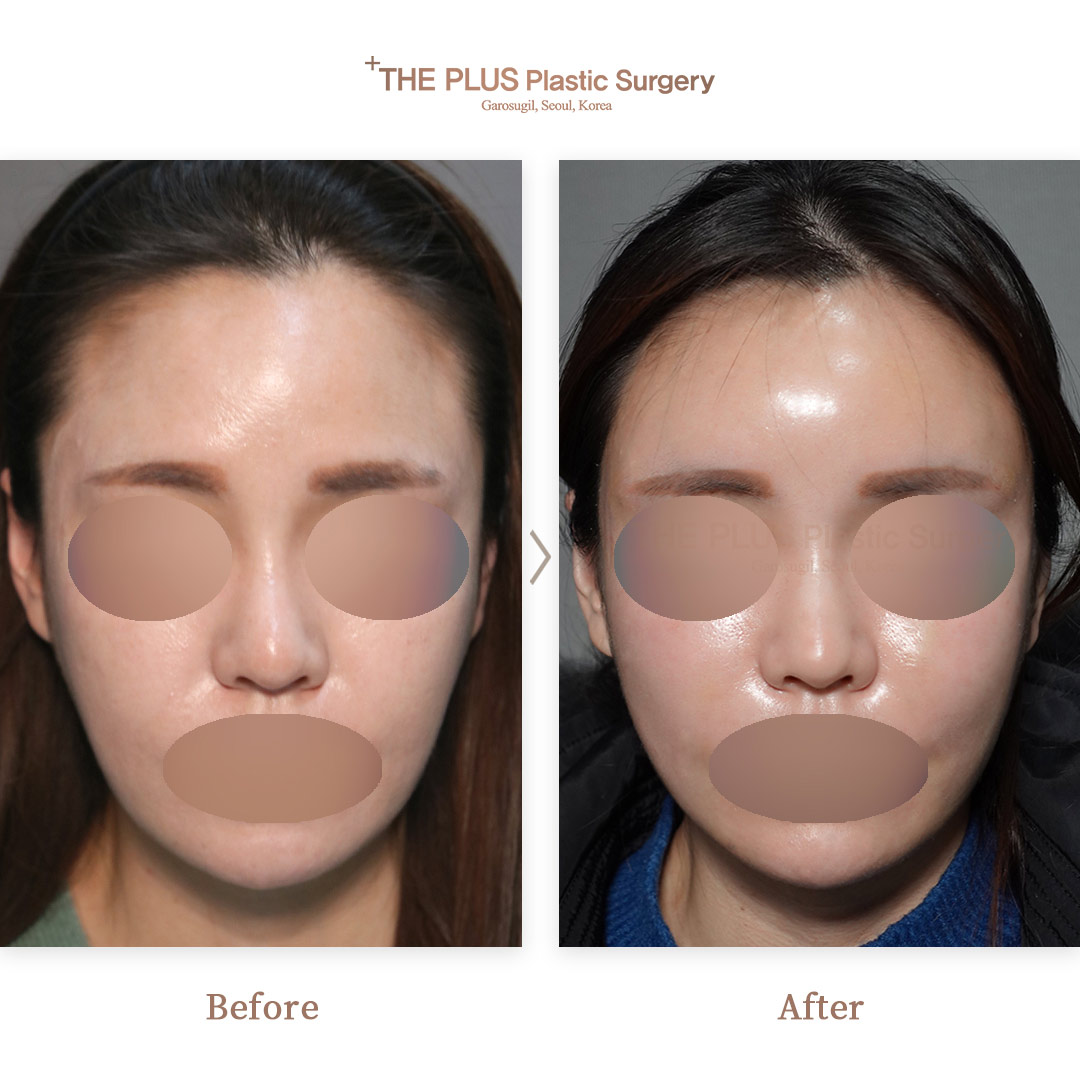 THE PLUS CLINIC KOREA -