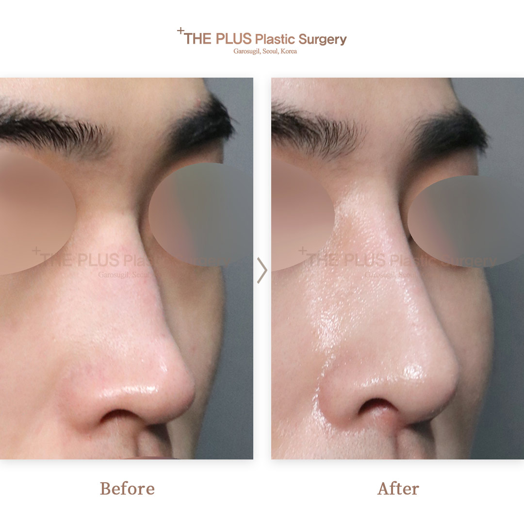 THE PLUS CLINIC KOREA -