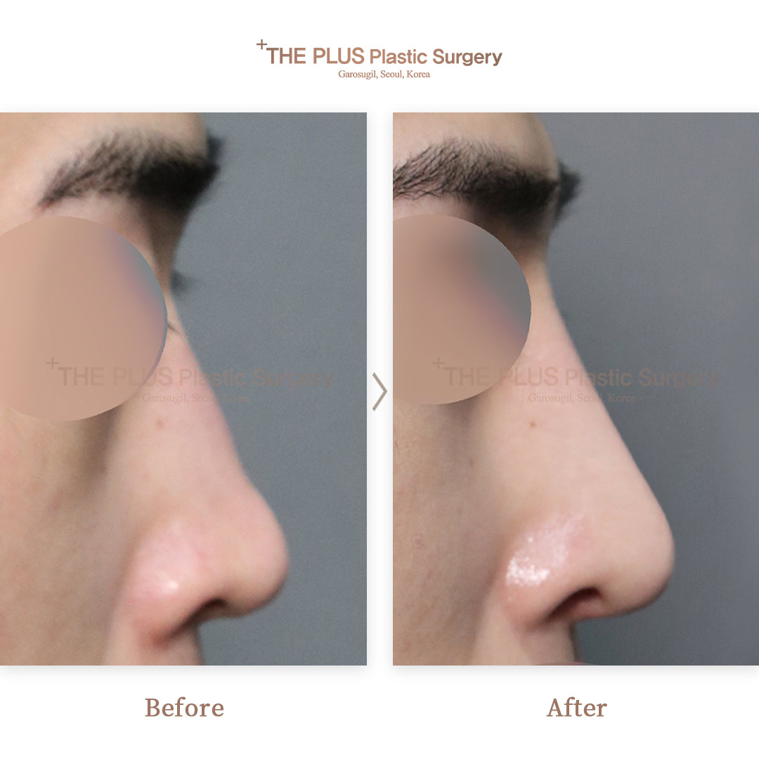 THE PLUS CLINIC KOREA -
