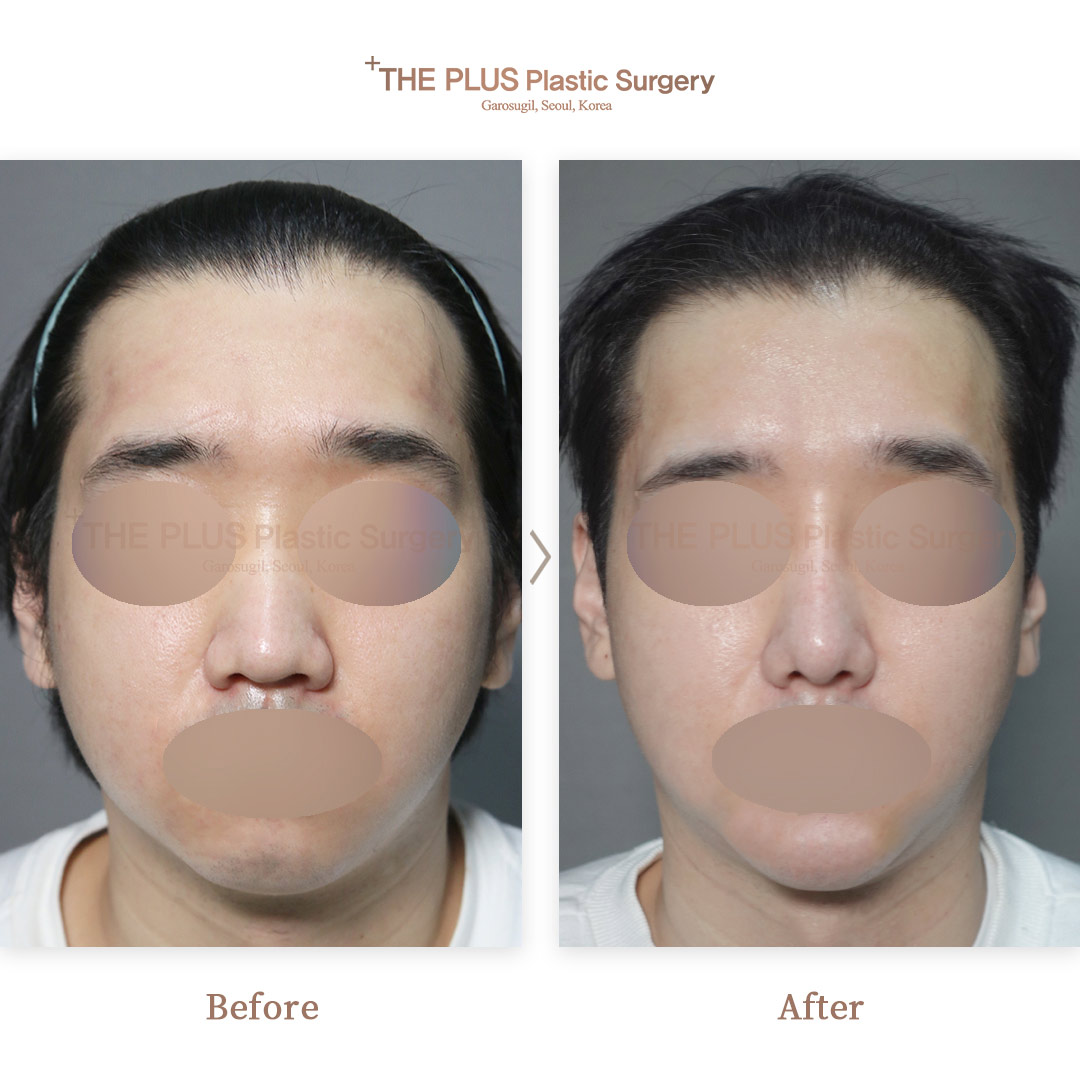 THE PLUS CLINIC KOREA -