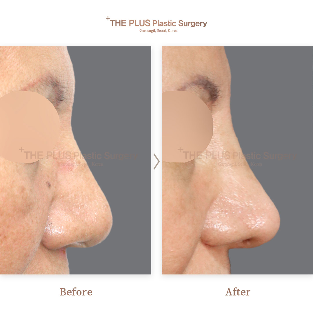 THE PLUS CLINIC KOREA -