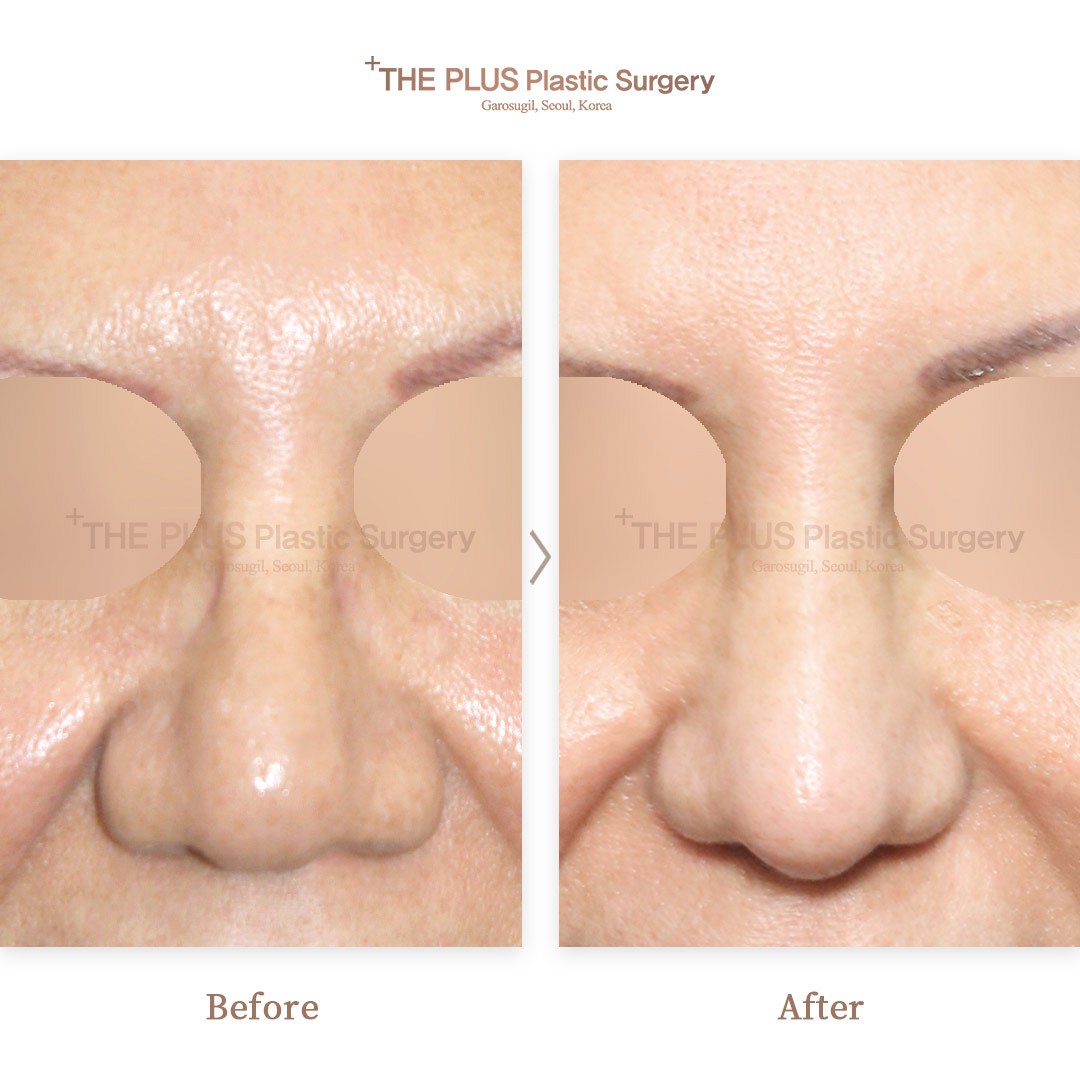 THE PLUS CLINIC KOREA -