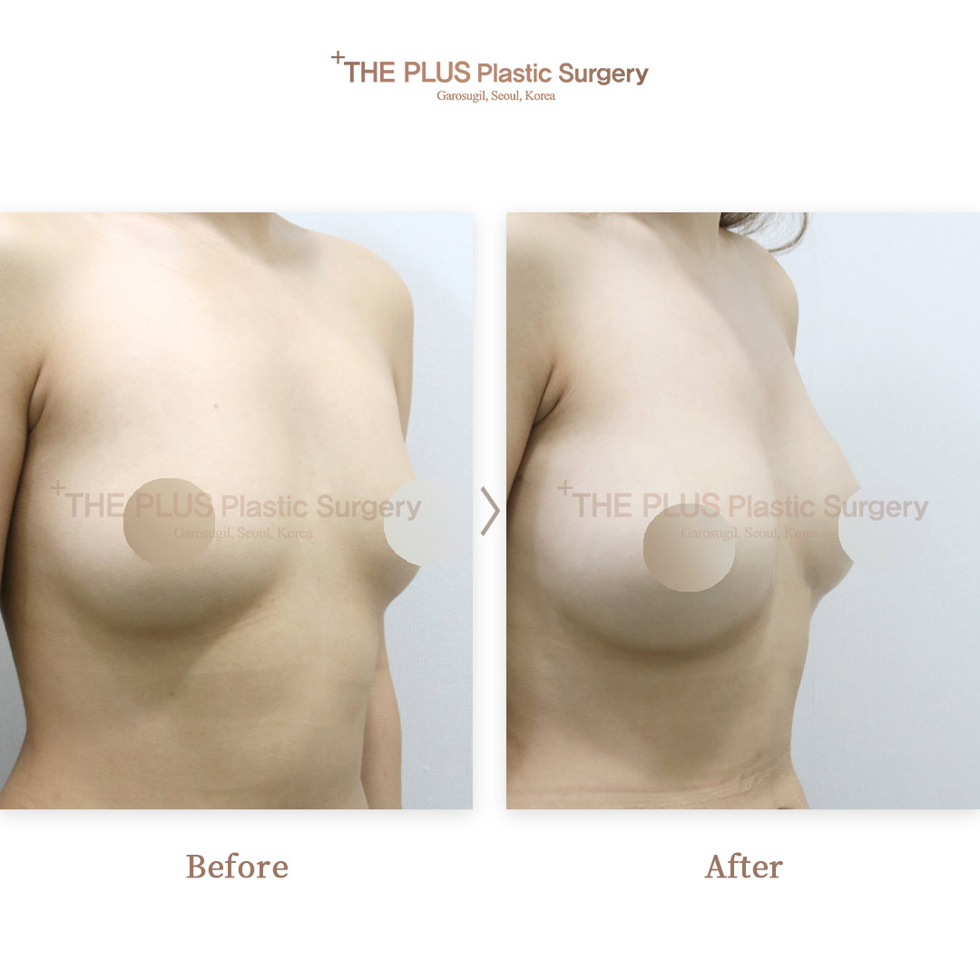 THE PLUS CLINIC KOREA -