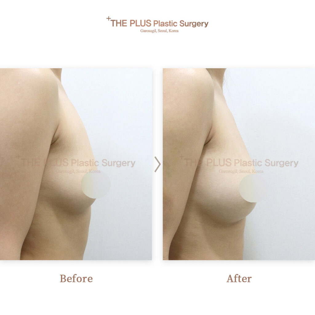 THE PLUS CLINIC KOREA -