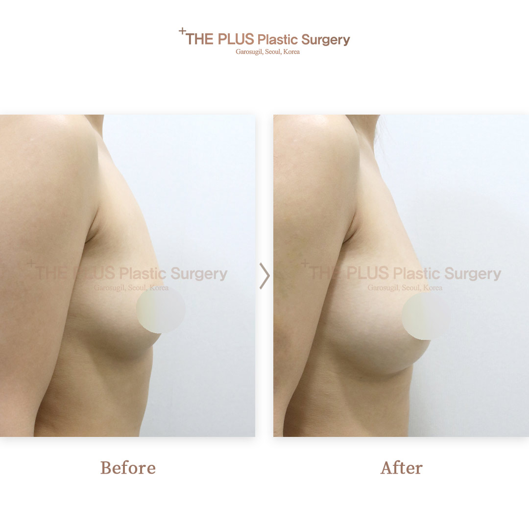 THE PLUS CLINIC KOREA -