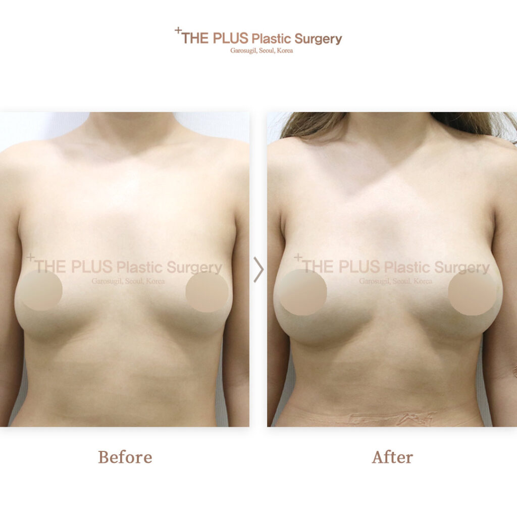 THE PLUS CLINIC KOREA -