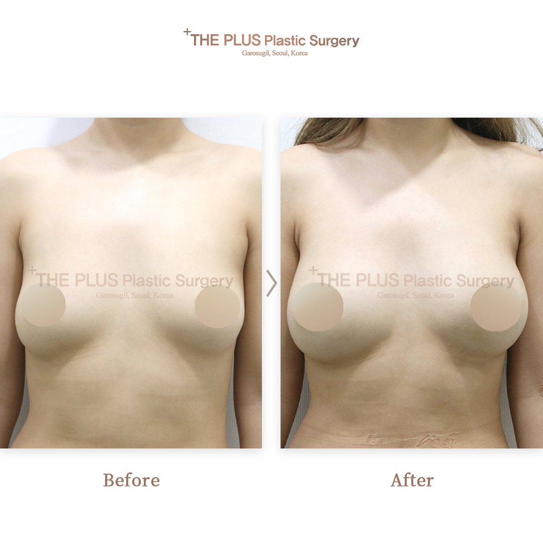 THE PLUS CLINIC KOREA -