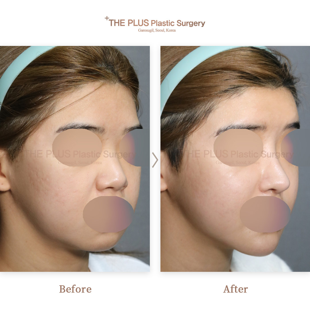 THE PLUS CLINIC KOREA -
