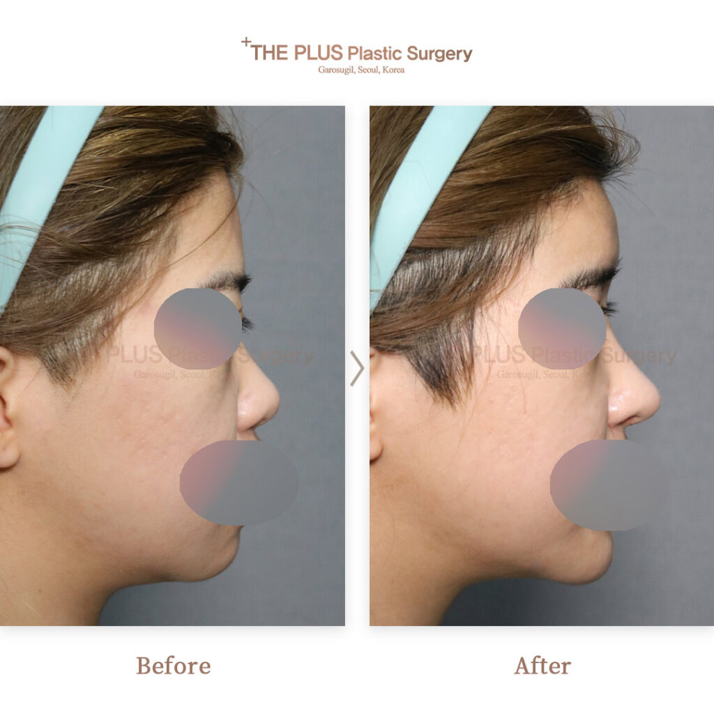 THE PLUS CLINIC KOREA -