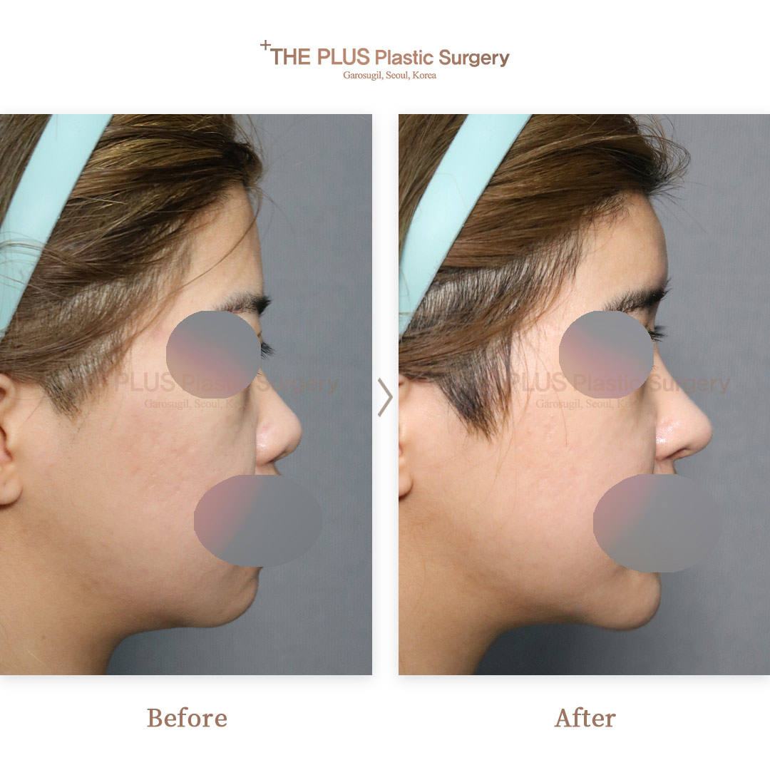 THE PLUS CLINIC KOREA -