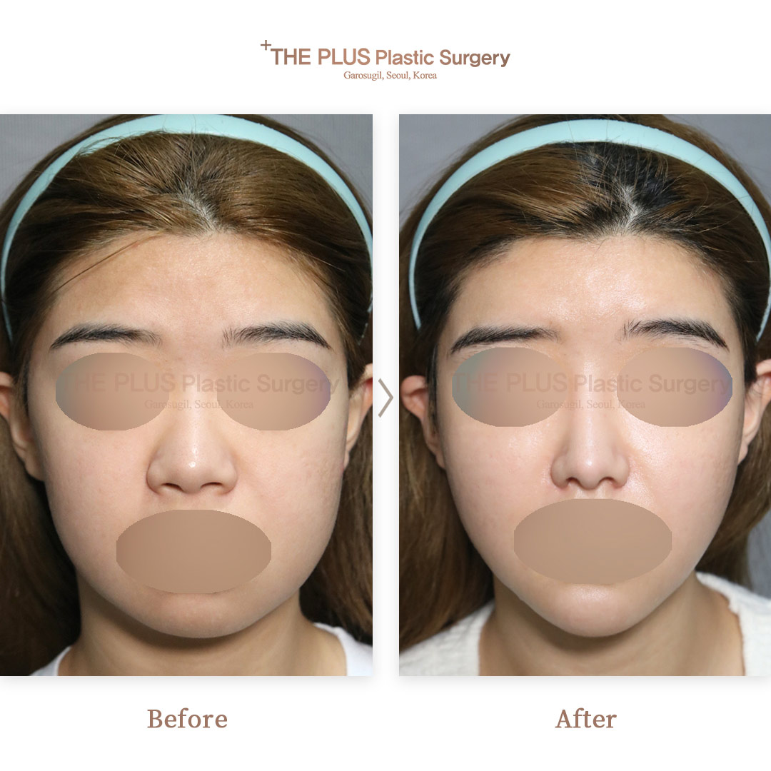 THE PLUS CLINIC KOREA -