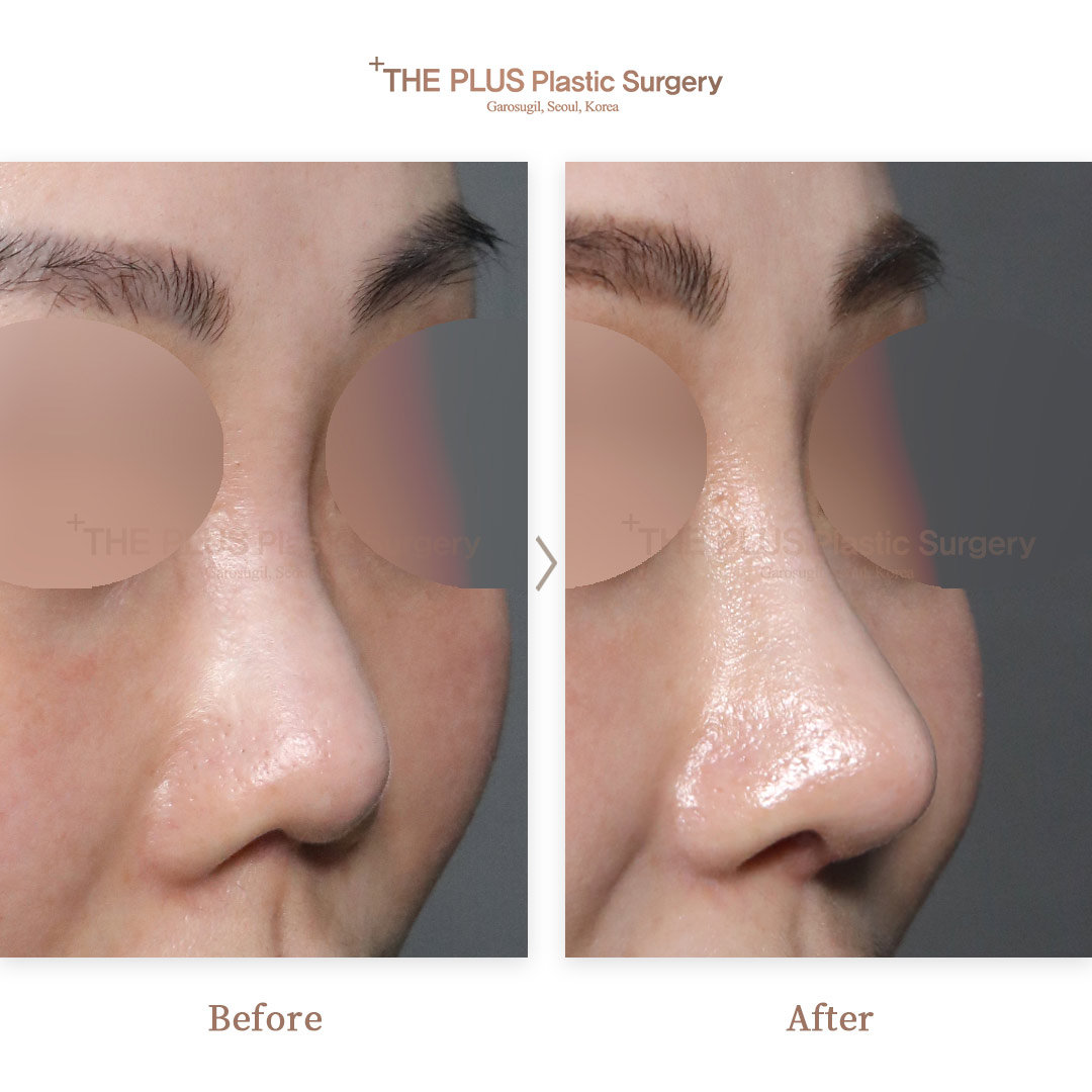 THE PLUS CLINIC KOREA -