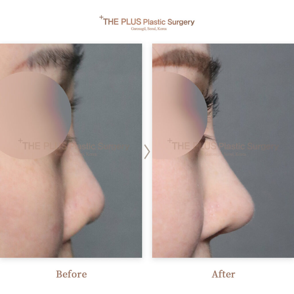 THE PLUS CLINIC KOREA -