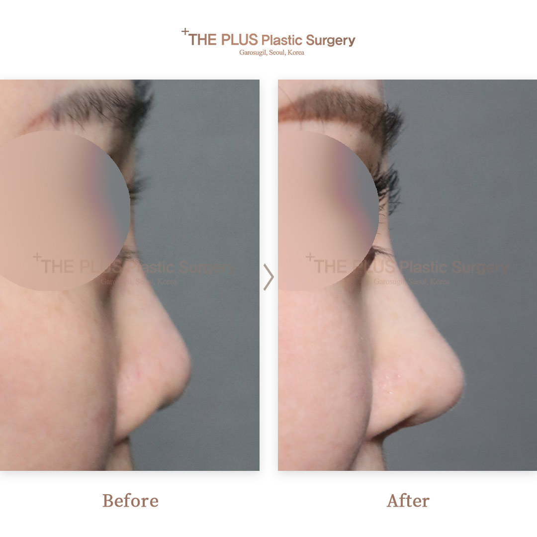 THE PLUS CLINIC KOREA -