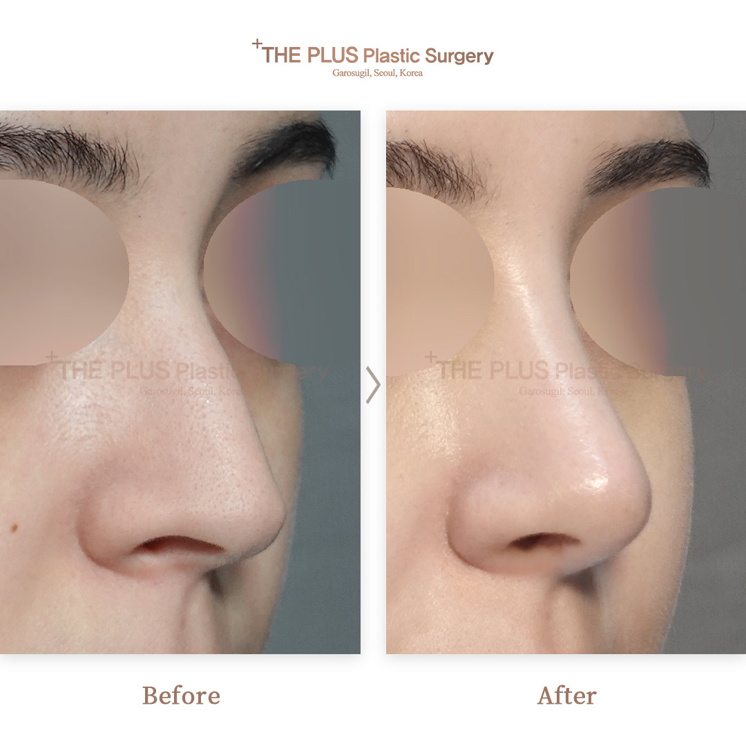 THE PLUS CLINIC KOREA -