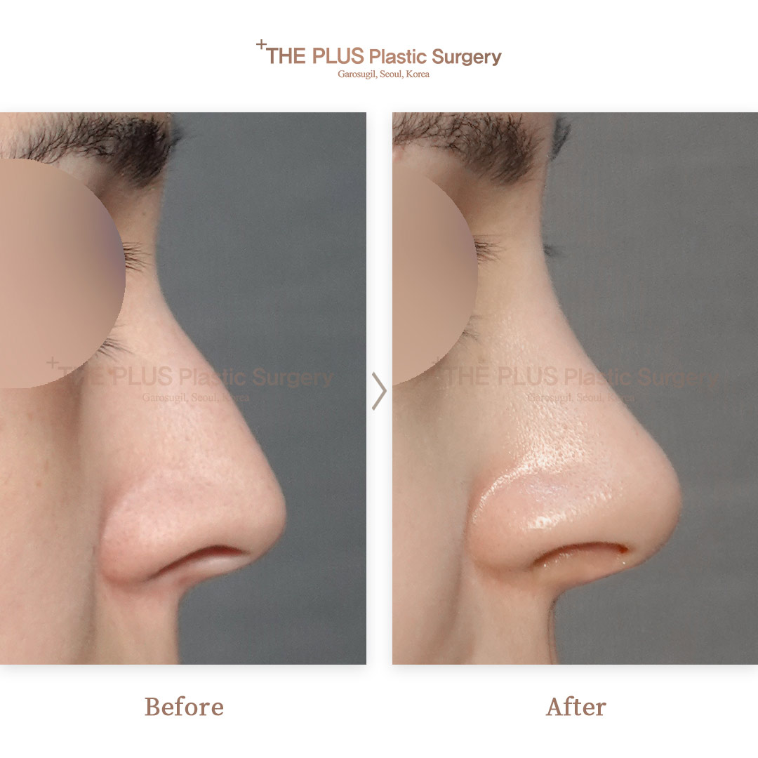 THE PLUS CLINIC KOREA -