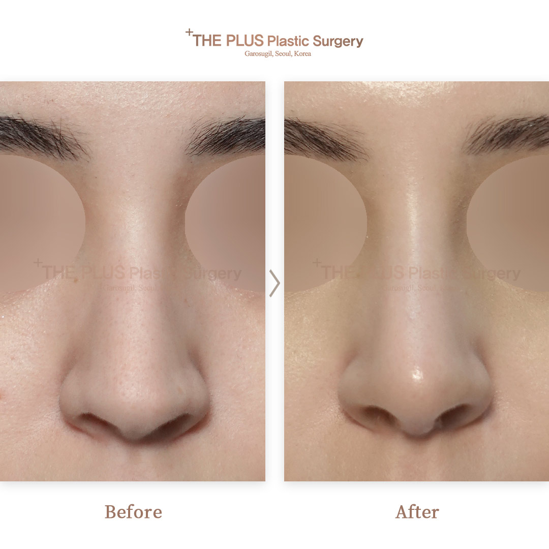 THE PLUS CLINIC KOREA -
