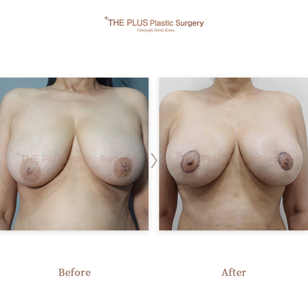 THE PLUS CLINIC KOREA -