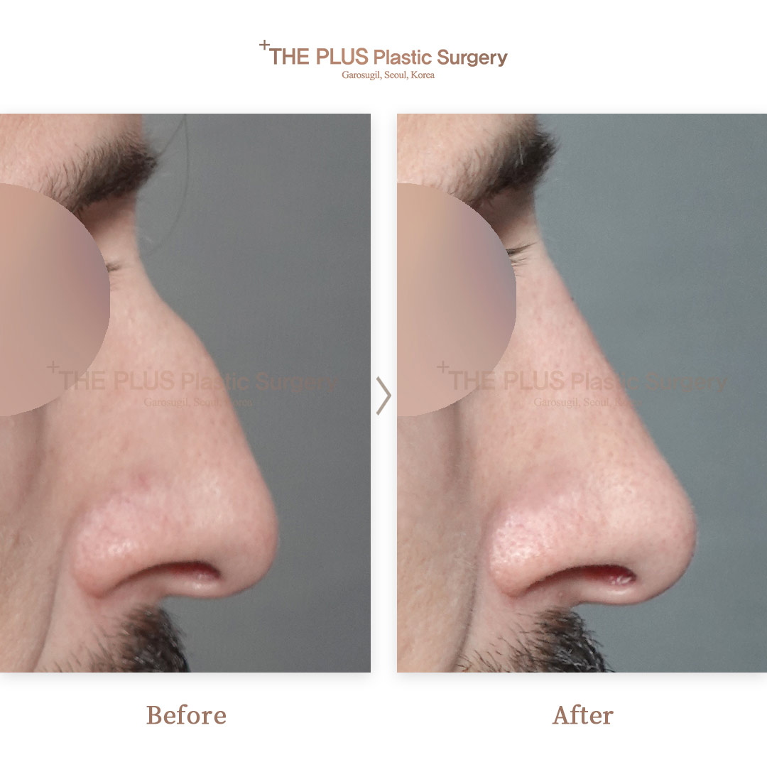 THE PLUS CLINIC KOREA -