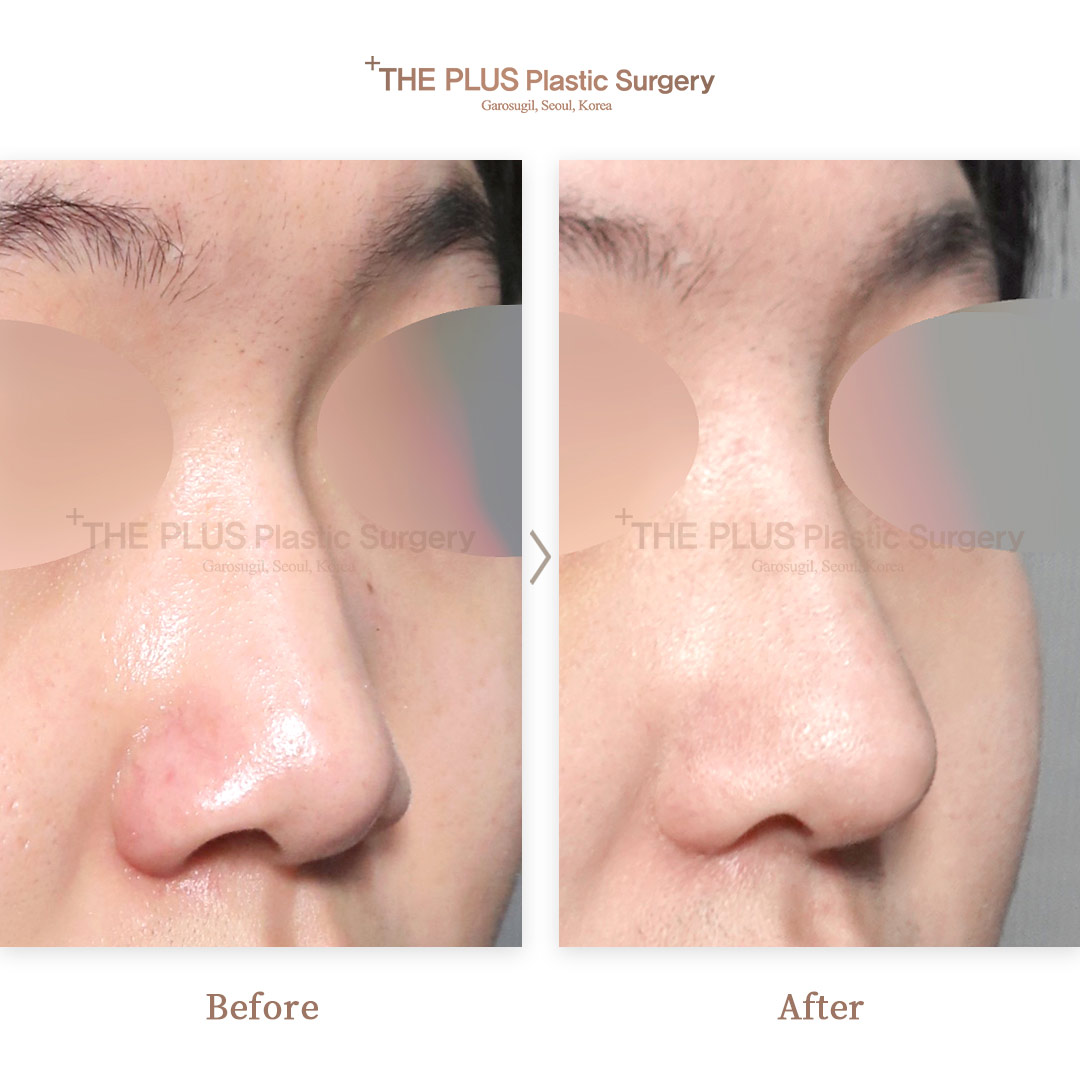 THE PLUS CLINIC KOREA -