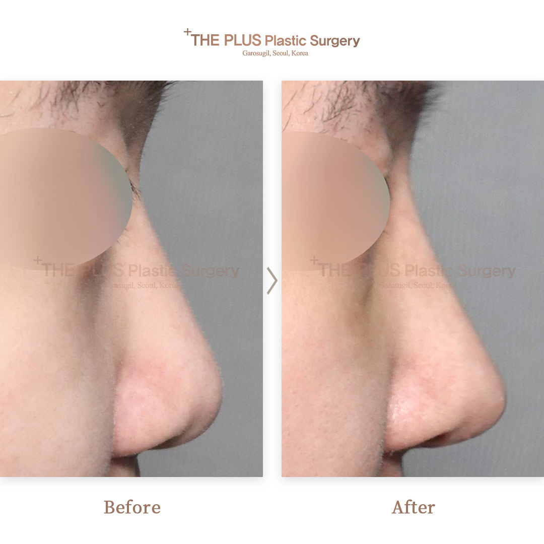 THE PLUS CLINIC KOREA -