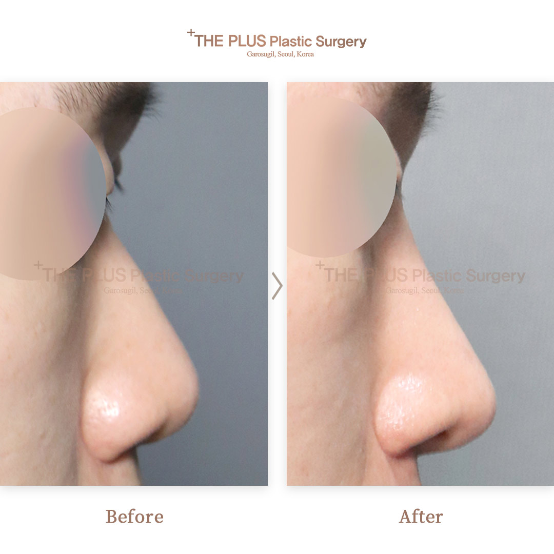 THE PLUS CLINIC KOREA -