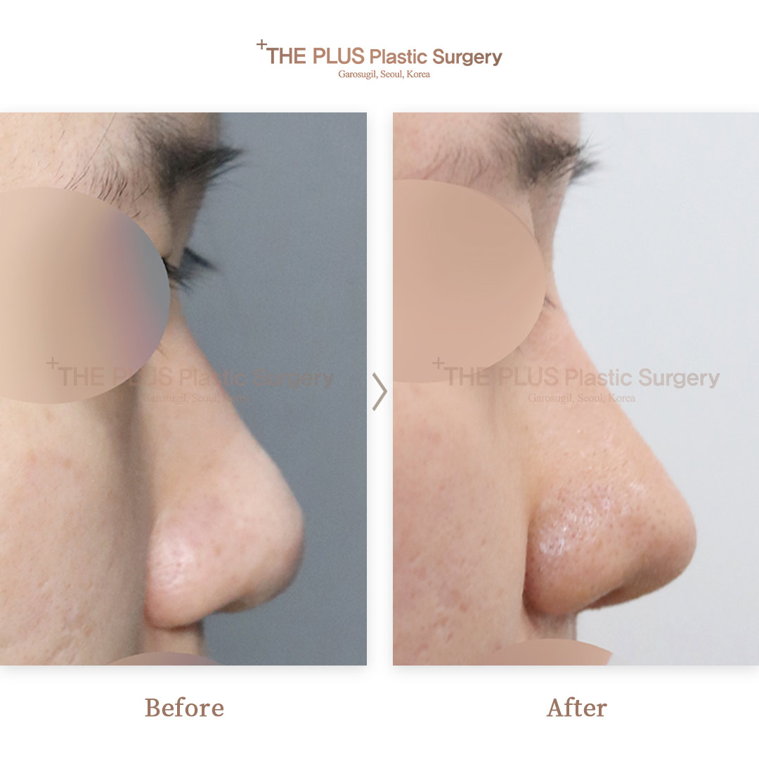 THE PLUS CLINIC KOREA -